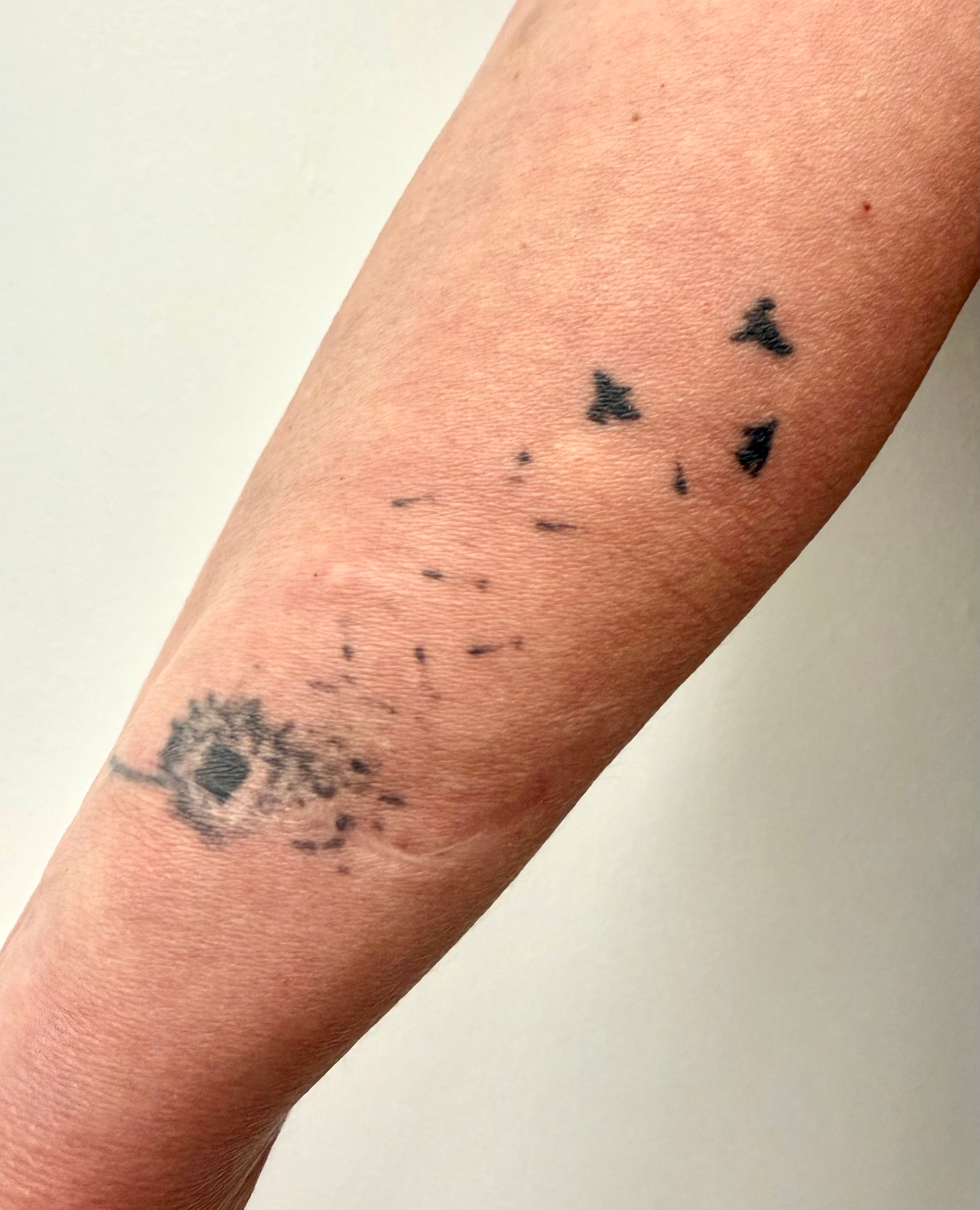 До: Floral Forearm Cover-Up Tattoo